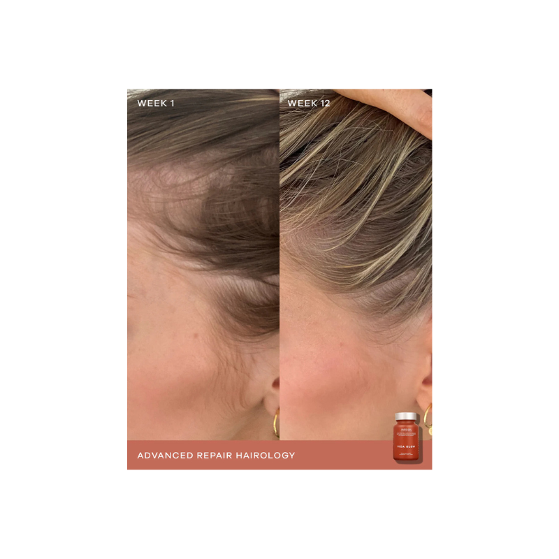 Vida Glow Hairology Advanced Repair