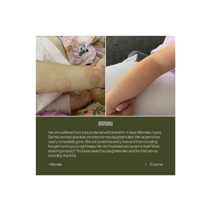 Mamaku Advanced Hydra Gel