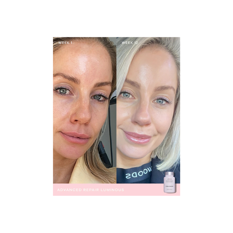 Vida Glow Luminous Advanced Repair