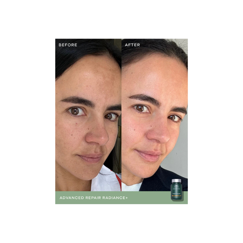 Vida Glow Radiance +