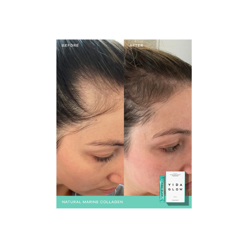Vida Glow Natural Marine Collagen Sachets - Mango