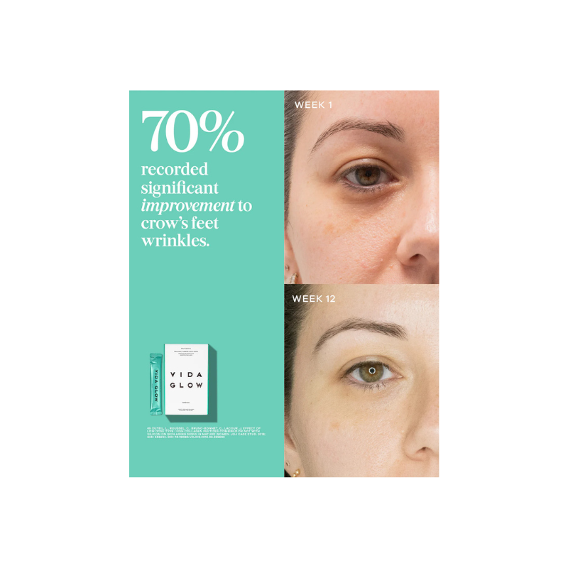 Vida Glow Natural Marine Collagen Sachets - Mango