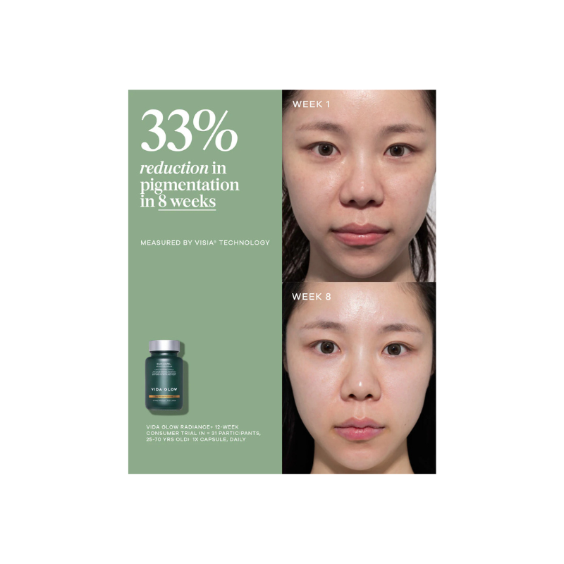 Vida Glow Radiance +